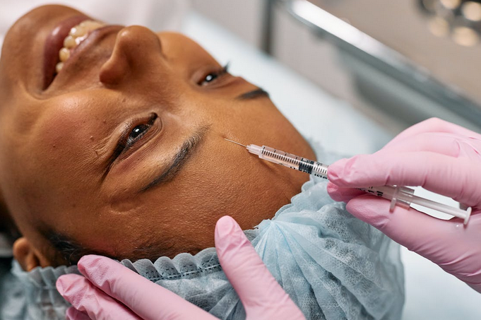 facelift